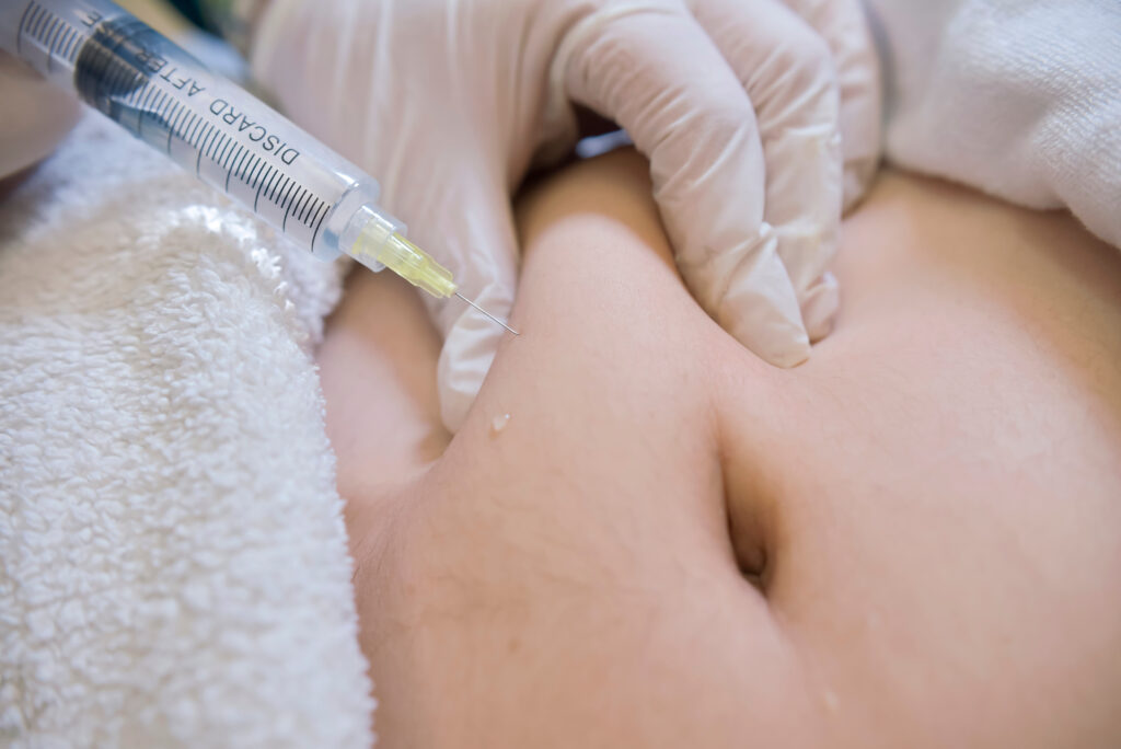 Closeup of a Lipotropic injection into the subcutaneous fat below the navel. Local Fat and Cellulite reduction procedure. Female aesthetic cosmetology in a beauty salon