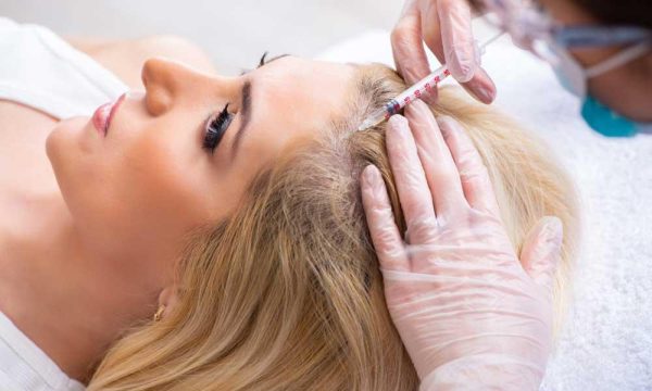 PRP treatment – Hair rejuvenation